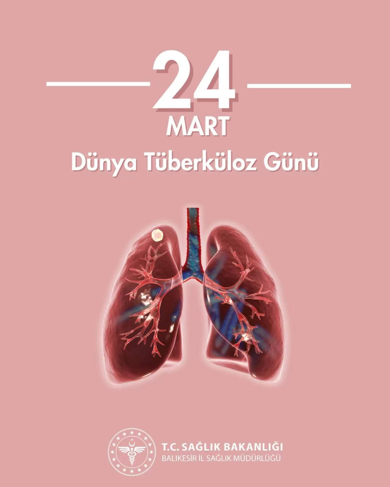 Balıkesir, Dünya Tüberküloz Günü'ne Dikkat Çekti