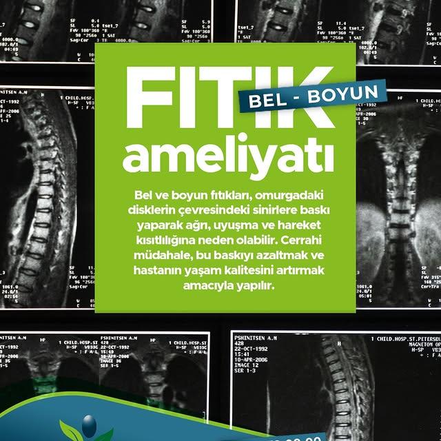 Bel ve Boyun Fıtığı Cerrahisi: Yaşam Kalitesini Artırmaya Yönelik Uzman Yaklaşımlar