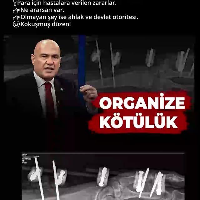 Sağlık Sektöründe Skandal İddialar: Gereksiz Ameliyatlar ve Kirli İlişkiler