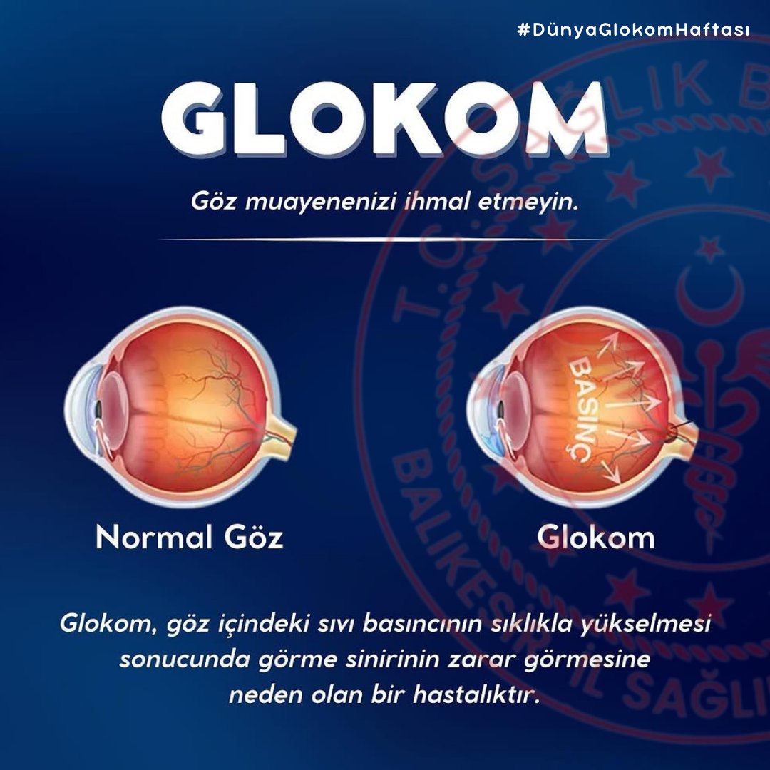 Balıkesir İl Sağlık Müdürlüğü’nden Glokom Farkındalığı